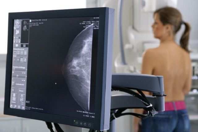 Гистологические виды рака молочной железы 37